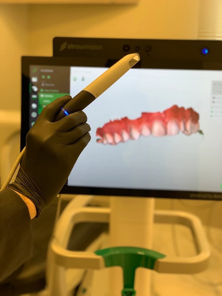 Escaneamento intraoral digital em andamento no consultório